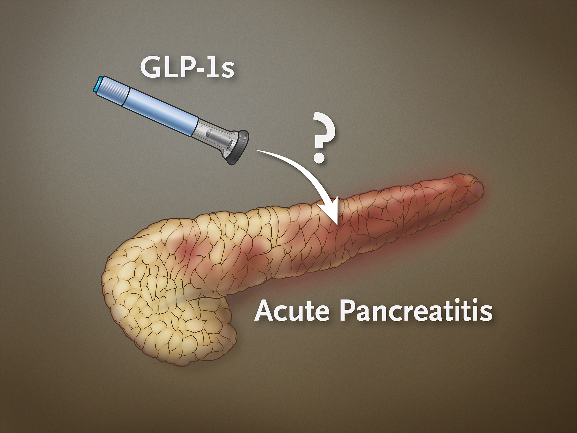 can you take glp 1 with pancreatitis Risk for Acute Pancreatitis from GLP-1s
